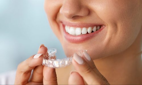 Best Teeth Whitening Trays